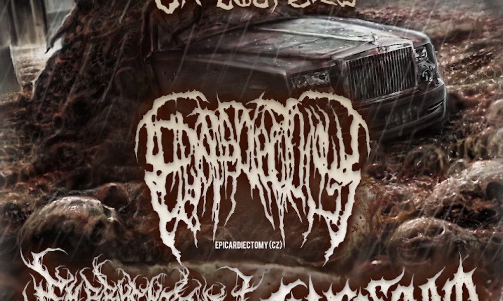 Epicardiectomy + Embryectomy + Inverecund